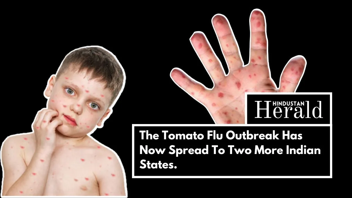The-Tomato-Flu-Outbreak-Has-Now-Spread-To-Two-More-Indian-States.