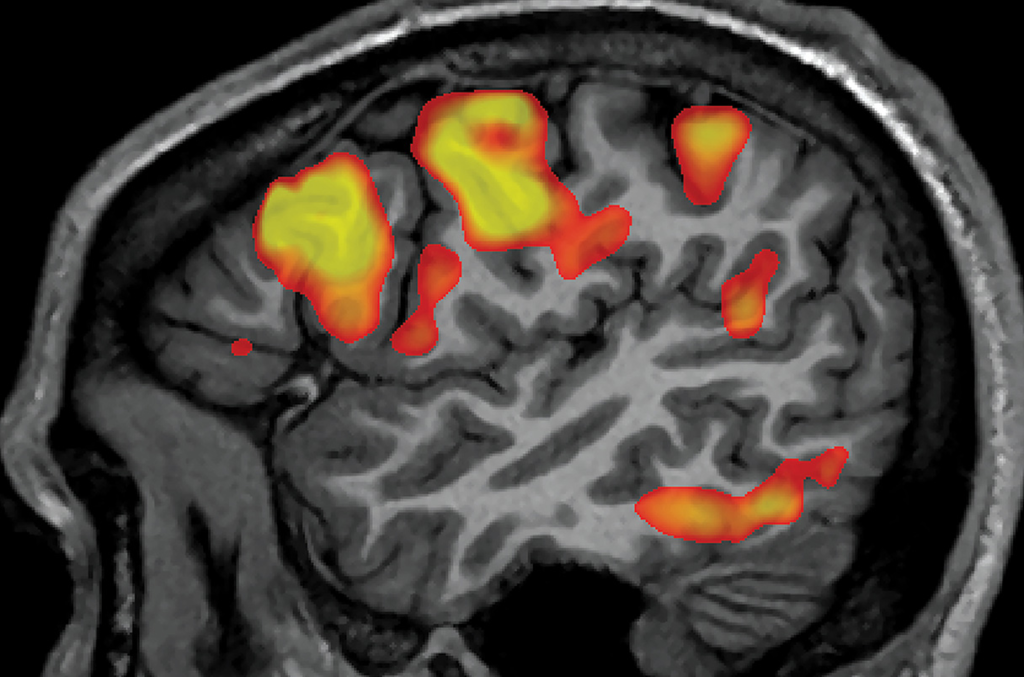 Scientists are using brain scans and artificial intelligence to decode human thoughts. Discover the potential applications of this technology, including brain-computer interfaces and improved artificial intelligence, as well as the ethical implications of accessing people's thoughts without their consent.

Drop Commands to Import
To export commands, pick them in command explorer and click Export
