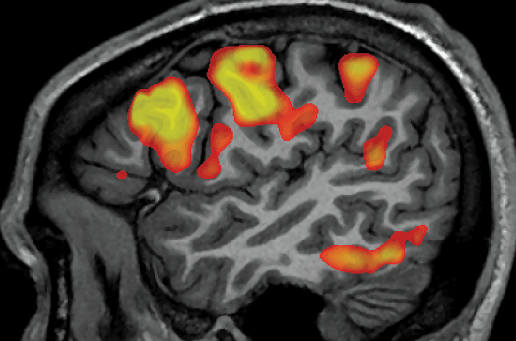 Scientists are using brain scans and artificial intelligence to decode human thoughts. Discover the potential applications of this technology, including brain-computer interfaces and improved artificial intelligence, as well as the ethical implications of accessing people's thoughts without their consent.

Drop Commands to Import
To export commands, pick them in command explorer and click Export
