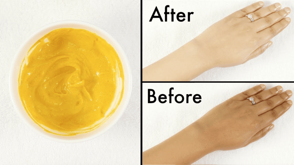 "A sun-kissed glow can turn into a tan, but you can restore your natural tone with these expert-recommended home remedies. Learn how to do a patch test for safe and effective tan removal."
